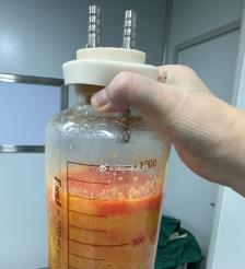 宜城水动力吸脂手术要做多久？